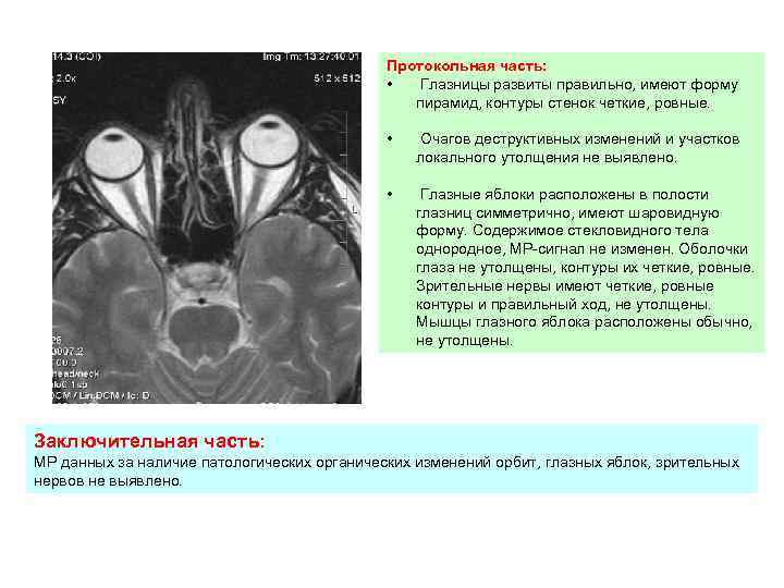 Протокольная часть: • Глазницы развиты правильно, имеют форму пирамид, контуры стенок четкие, ровные. •