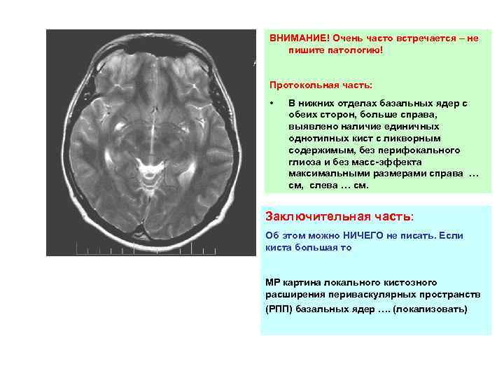 ВНИМАНИЕ! Очень часто встречается – не пишите патологию! Протокольная часть: • В нижних отделах