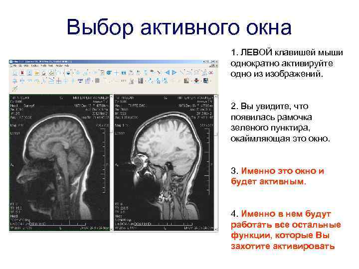 Выбор активного окна 1. ЛЕВОЙ клавишей мыши однократно активируйте одно из изображений. 2. Вы