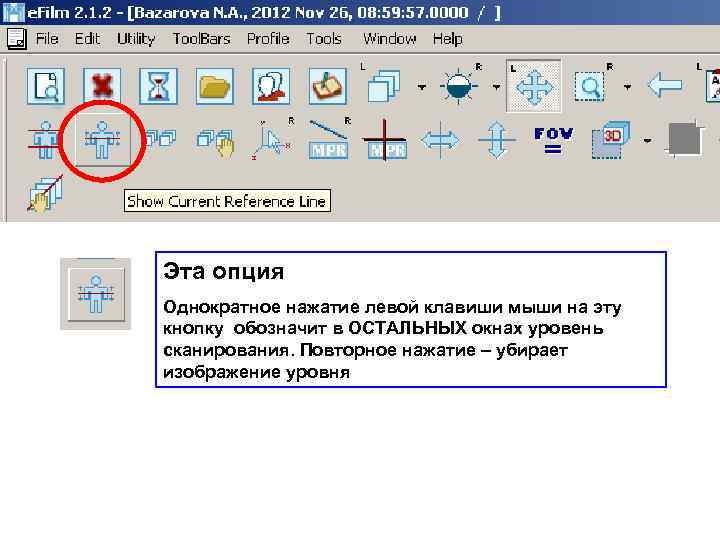 Эта опция Однократное нажатие левой клавиши мыши на эту кнопку обозначит в ОСТАЛЬНЫХ окнах