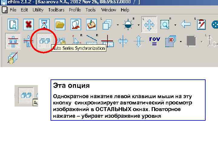 Эта опция Однократное нажатие левой клавиши мыши на эту кнопку синхронизирует автоматический просмотр изображений