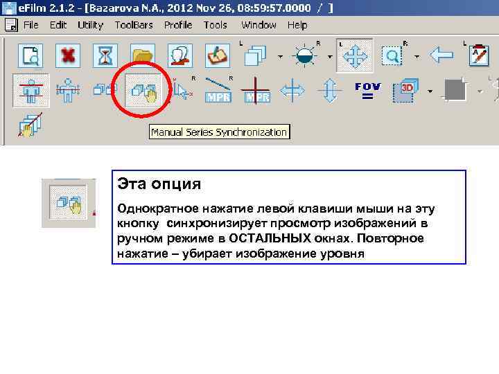 Эта опция Однократное нажатие левой клавиши мыши на эту кнопку синхронизирует просмотр изображений в