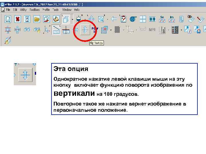 Эта опция Однократное нажатие левой клавиши мыши на эту кнопку включает функцию поворота изображения