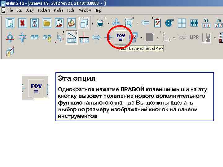 Эта опция Однократное нажатие ПРАВОЙ клавиши мыши на эту кнопку вызовет появление нового дополнительного