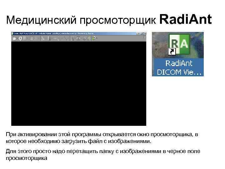 Медицинский просмоторщик Radi. Ant При активировании этой программы открывается окно просмоторщика, в которое необходимо