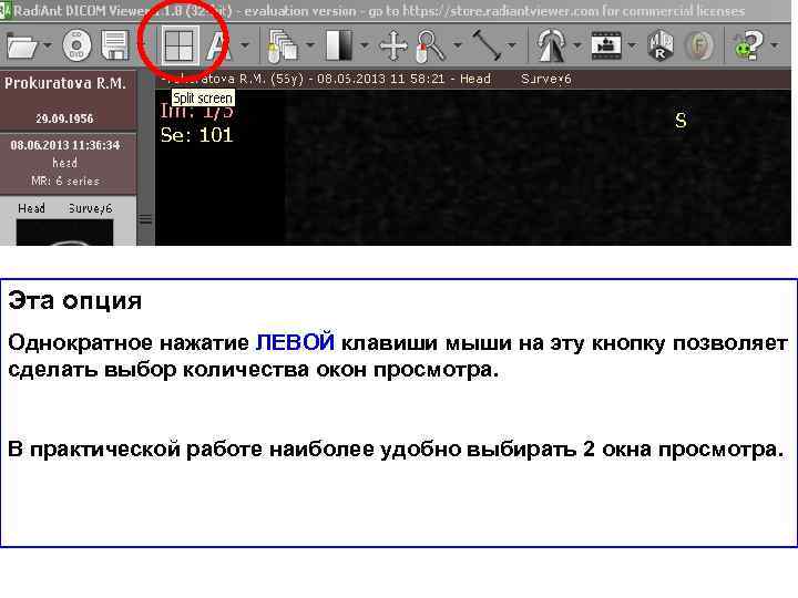 Эта опция Однократное нажатие ЛЕВОЙ клавиши мыши на эту кнопку позволяет сделать выбор количества