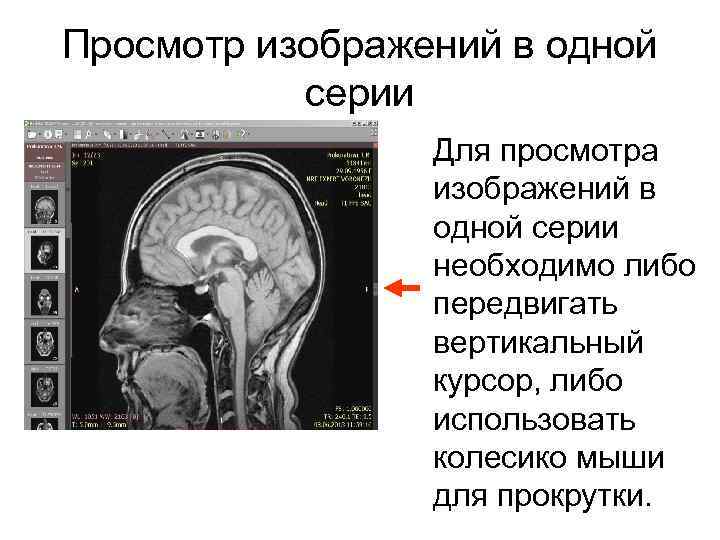 Просмотр изображений в одной серии Для просмотра изображений в одной серии необходимо либо передвигать