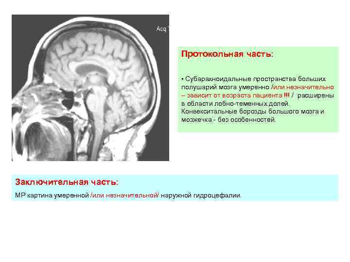 Конвекситальные пространства