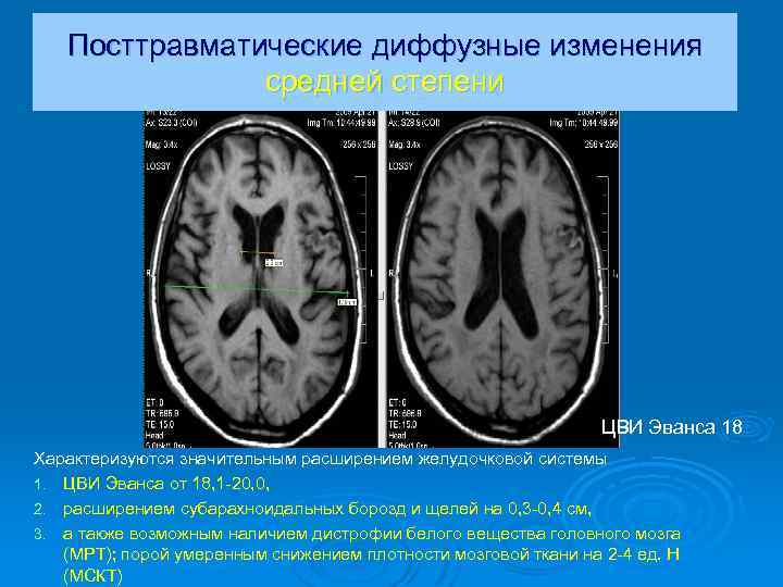 Изменения головного