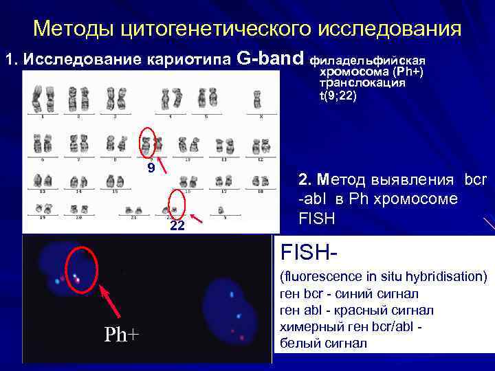 Цитогенетический метод картинки