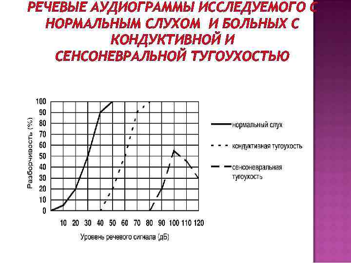 Аудиограмма слуха что это