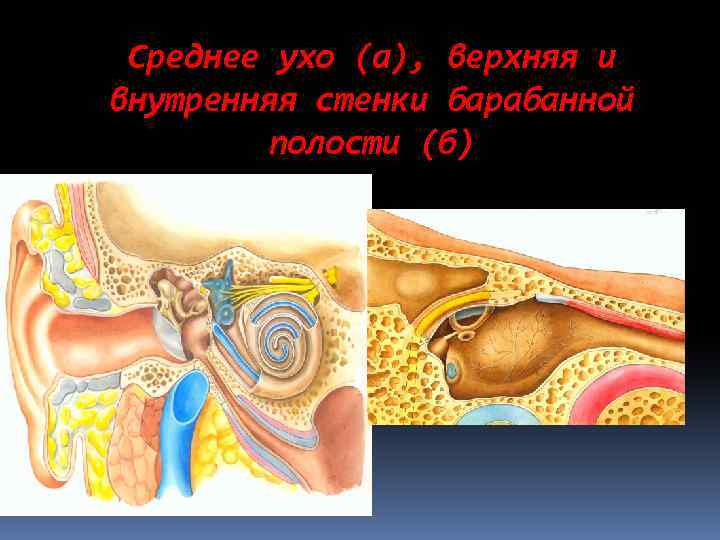 Cреднее ухо (а), верхняя и внутренняя стенки барабанной полости (б) 