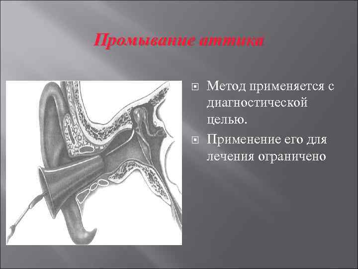 Промывание аттика Метод применяется с диагностической целью. Применение его для лечения ограничено 
