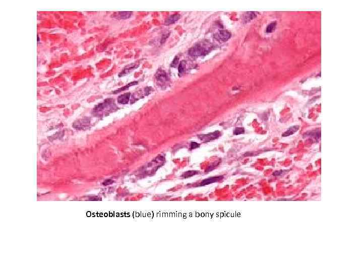 Osteoblasts (blue) rimming a bony spicule 