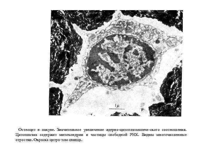Остеоцит в лакуне. Значительное увеличение ядерно цитоплазматиче ского соотношения. Цитоплазма содержит митохондрии и частицы
