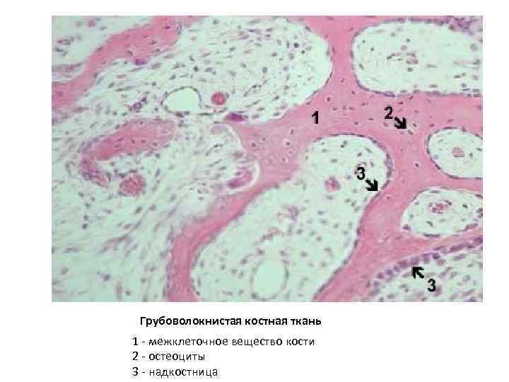 Грубоволокнистая костная ткань 1 - межклеточное вещество кости 2 - остеоциты 3 - надкостница
