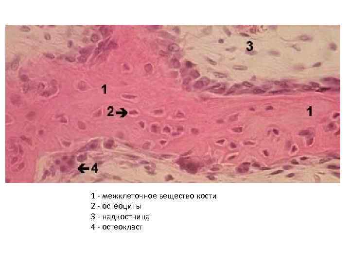 1 - межклеточное вещество кости 2 - остеоциты 3 - надкостница 4 - остеокласт