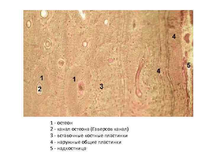 1 - остеон 2 - канал остеона (Гаверсов канал) 3 - вставочные костные пластинки