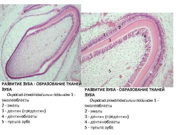Гистология схема зуба