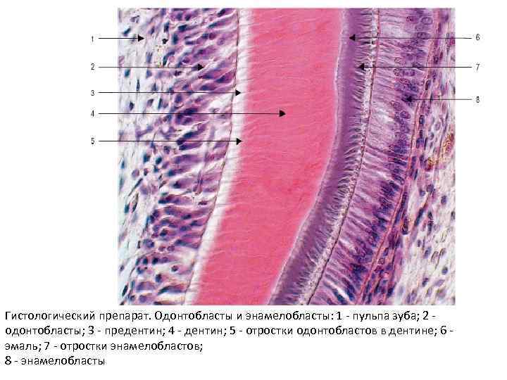 Гистологическое строение тканей зуба. Периодонт гистология. Перидонт гистология препарат. Дентин пульпа гистология препарат. Одонтобласты гистология.