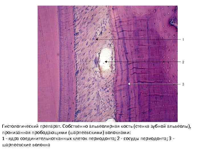 Гистологический препарат. Собственно альвеолярная кость (стенка зубной альвеолы), пронизанная прободающими (шарпеевскими) волокнами: 1 -