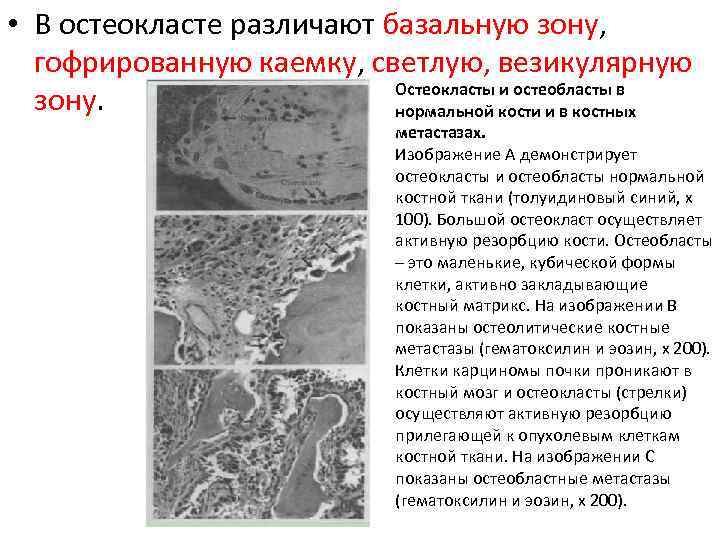  • В остеокласте различают базальную зону, гофрированную каемку, светлую, везикулярную Остеокласты и остеобласты