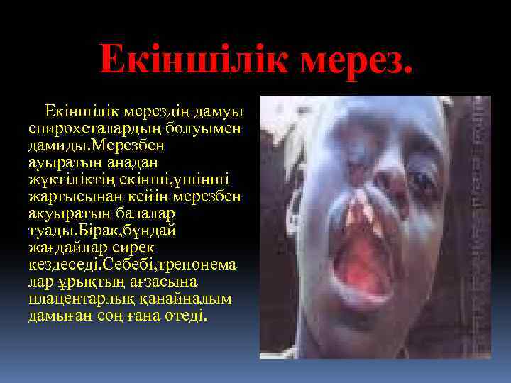 Екіншілік мерез. Екіншілік мерездің дамуы спирохеталардың болуымен дамиды. Мерезбен ауыратын анадан жүктіліктің екінші, үшінші