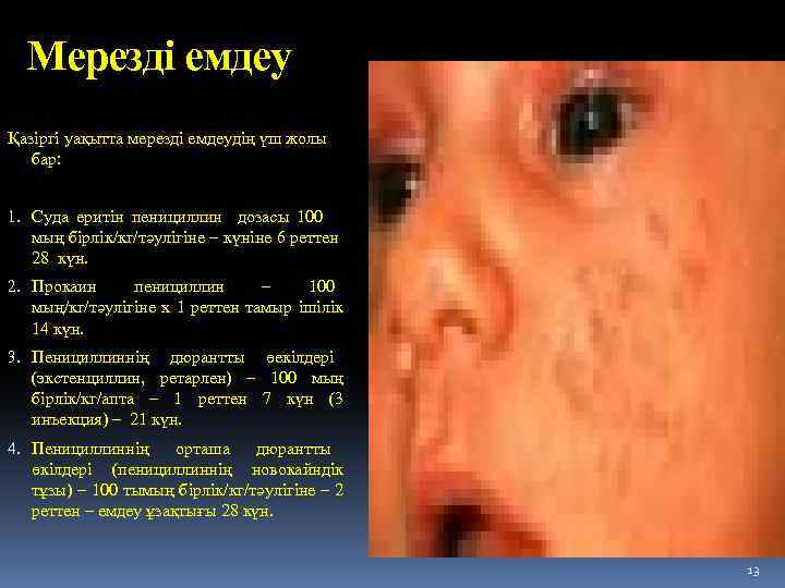 Мерезді емдеу Қазіргі уақытта мерезді емдеудің үш жолы бар: 1. Суда еритін пенициллин дозасы