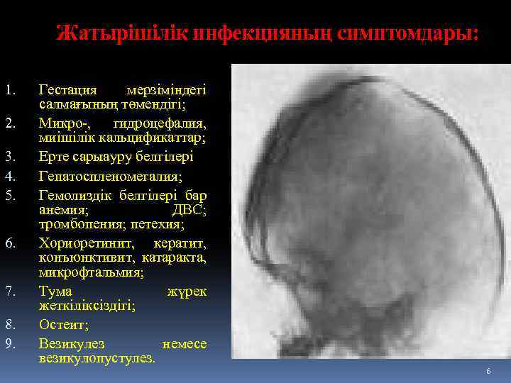 Жатырішілік инфекцияның симптомдары: 1. 2. 3. 4. 5. 6. 7. 8. 9. Гестация мерзіміндегі