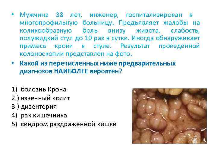  • Мужчина 38 лет, инженер, госпитализирован в многопрофильную больницу. Предъявляет жалобы на коликообразную