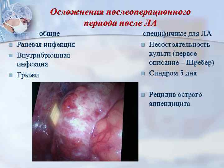 Осложнения послеоперационного периода после ЛА n n n общие Раневая инфекция Внутрибрюшная инфекция Грыжи
