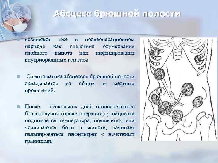 Абсцесс брюшной полости n возникают уже в послеоперационном периоде как следствие осумкования гнойного выпота