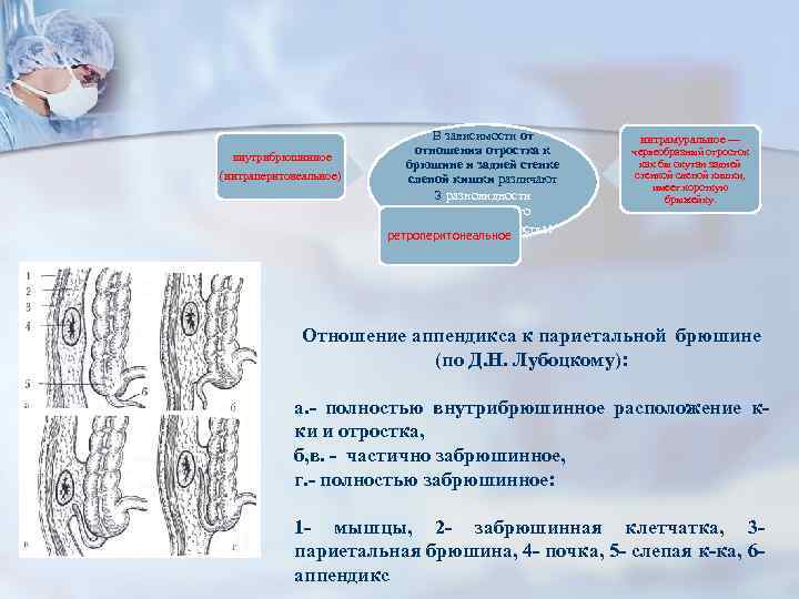  внутрибрюшинное (интраперитонеальное) В зависимости от отношения отростка к брюшине и задней стенке слепой