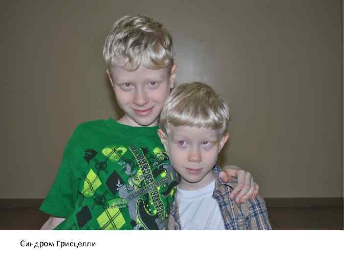 Синдром Грисцелли 