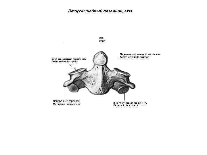 Второй шейный позвонок, axis Зуб Dens Верхняя суставная поверхность Facies articularis superior Поперечный отросток