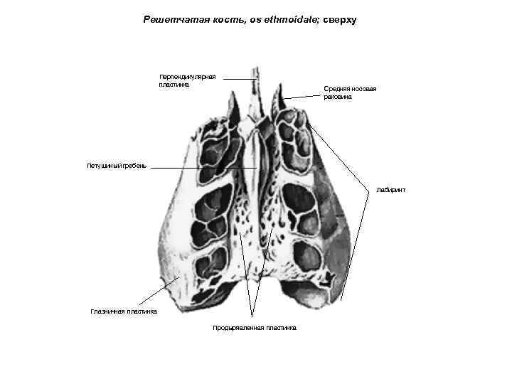 Решетчатая кость, os ethmoidale; сверху Перпендикулярная пластинка Средняя носовая раковина Петушиный гребень Лабиринт Глазничная