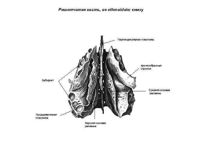 Решетчатая кость, os ethmoidale; снизу Перпендикулярная пластинка Крючкообразный отросток Лабиринт Средняя носовая раковина Продырявленная