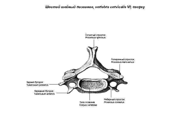 Шестой шейный позвонок, vertebra cervicalis VI; сверху Остистый отросток Processus spinosus Поперечный отросток Processus