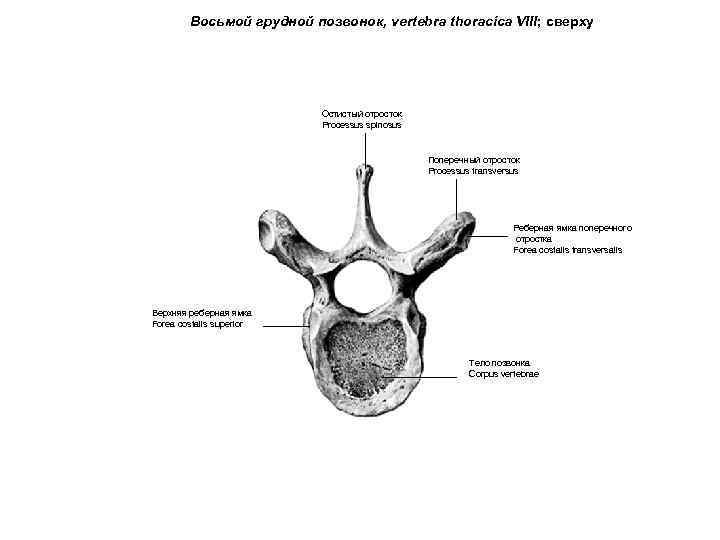 Восьмой грудной позвонок, vertebra thoracica VIII; сверху Остистый отросток Processus spinosus Поперечный отросток Processus