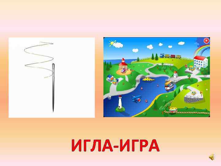 ИГЛА-ИГРА 