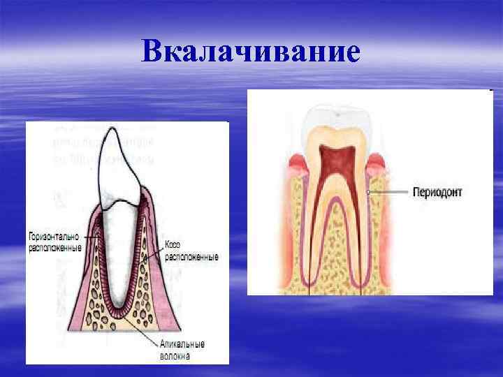 Вкалачивание 