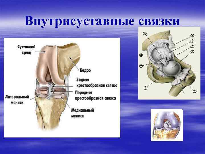 Латеральный мениск