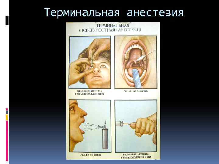 Анестезия в офтальмологии презентация