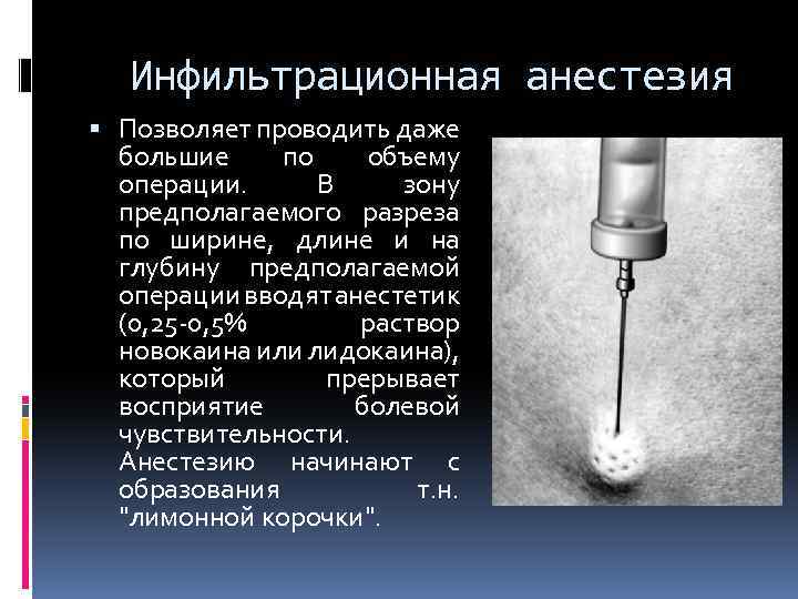 Инфильтрационная анестезия Позволяет проводить даже большие по объему операции. В зону предполагаемого разреза по