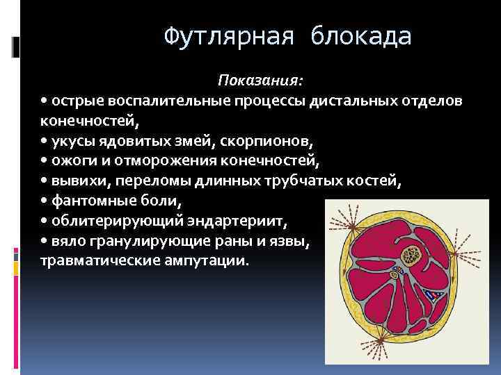 Футлярная блокада Показания: • острые воспалительные процессы дистальных отделов конечностей, • укусы ядовитых змей,