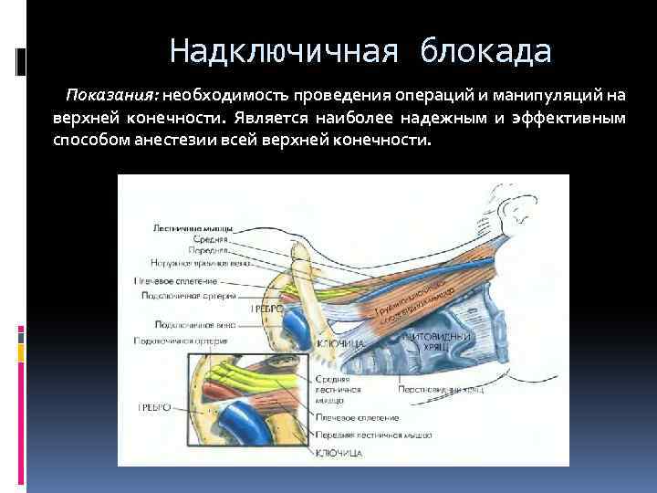Надключичная блокада Показания: необходимость проведения операций и манипуляций на верхней конечности. Является наиболее надежным