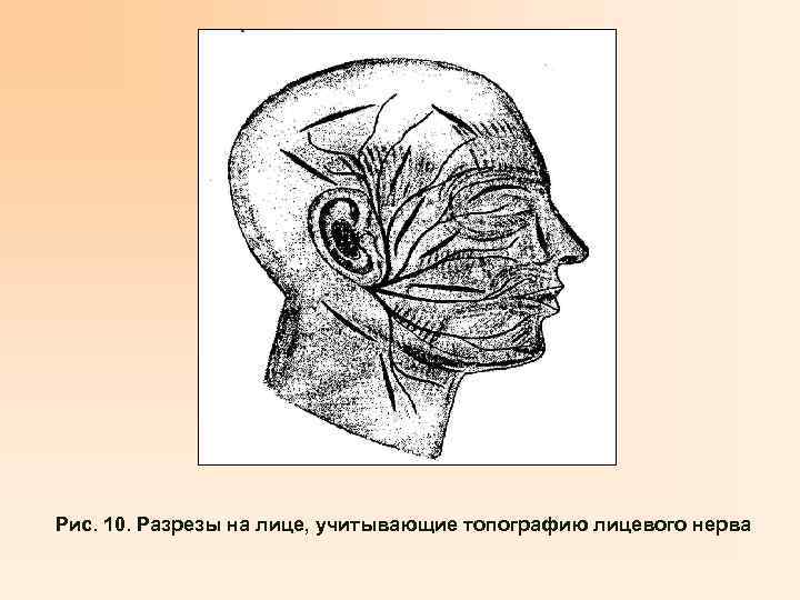 Рис. 10. Разрезы на лице, учитывающие топографию лицевого нерва 