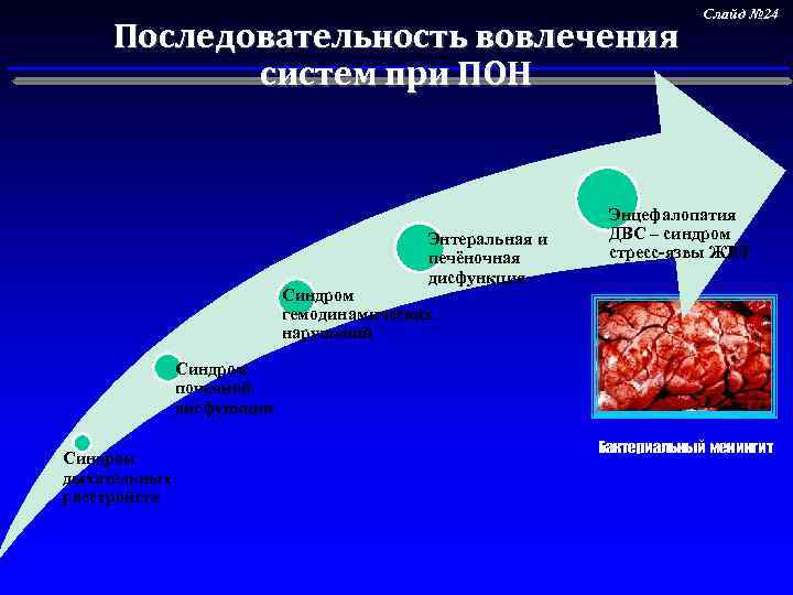 Последовательность вовлечения систем при ПОН Энтеральная и печёночная дисфункция Слайд № 24 Энцефалопатия ДВС
