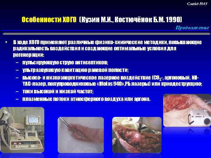 Слайд № 43 Особенности ХОГО (Кузин М. И. , Костючёнок Б. М. 1990) Продолжение