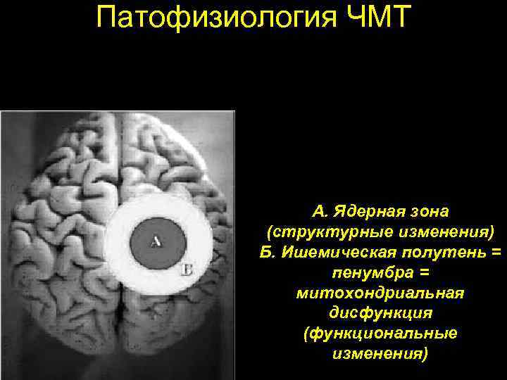 Патофизиология ЧМТ А. Ядерная зона (структурные изменения) Б. Ишемическая полутень = пенумбра = митохондриальная